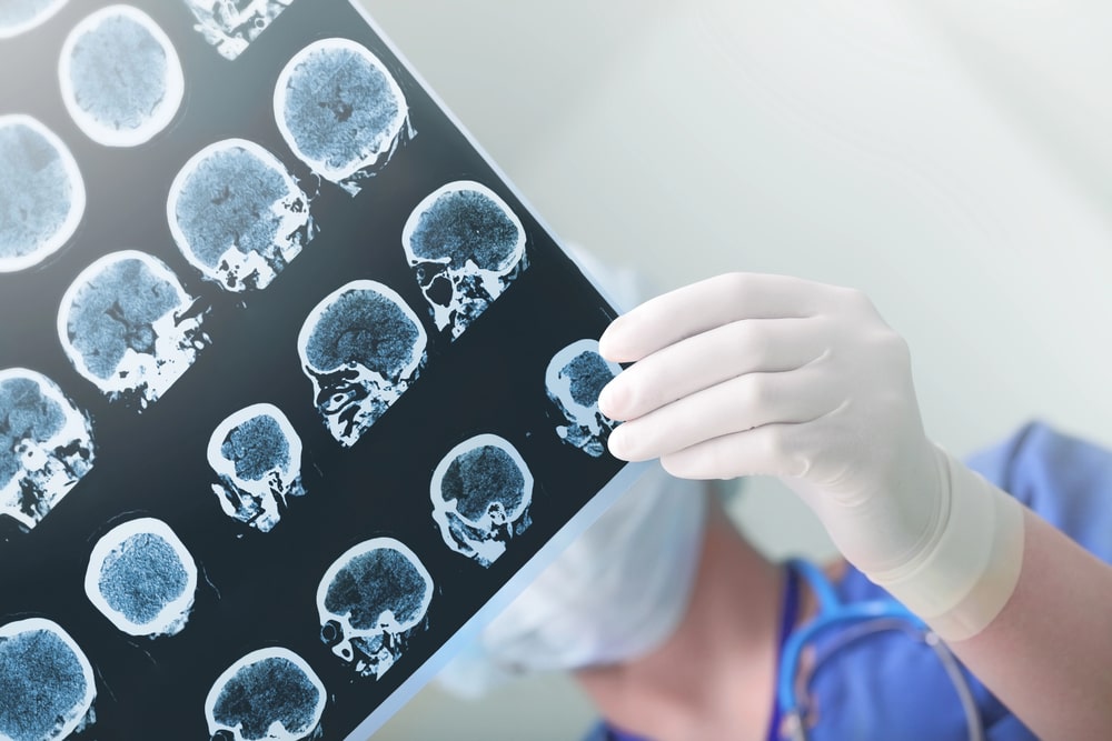 traumatic brain injury lawyer Oklahoma City, OK